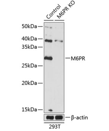 M6PR Rabbit Polyclonal Antibody [KO Validated]