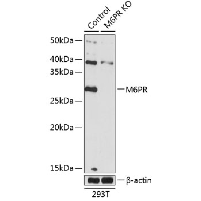 M6PR Rabbit Polyclonal Antibody [KO Validated]