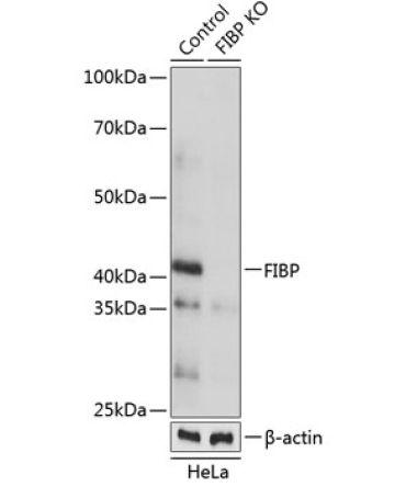 FIBP Rabbit Polyclonal Antibody [KO Validated]