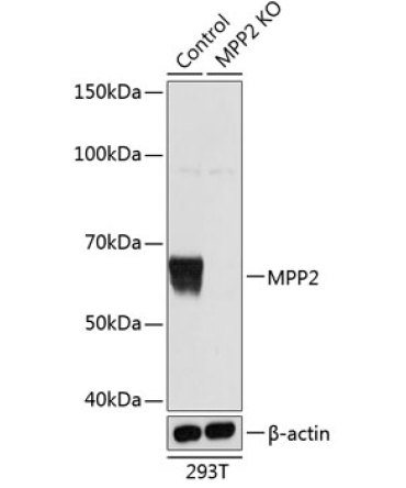 MPP2 Rabbit Polyclonal Antibody [KO Validated]