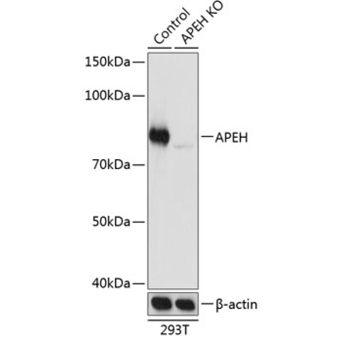 APEH Rabbit Polyclonal Antibody [KO Validated]