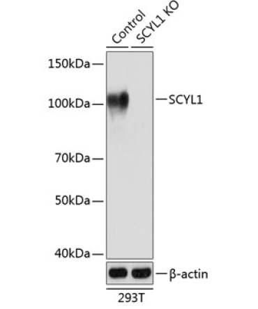 SCYL1 Rabbit Polyclonal Antibody [KO Validated]