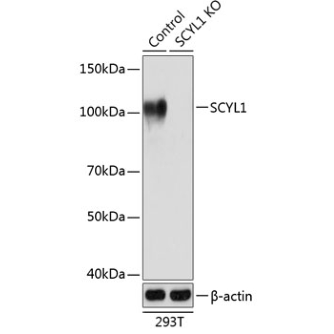 SCYL1 Rabbit Polyclonal Antibody [KO Validated]