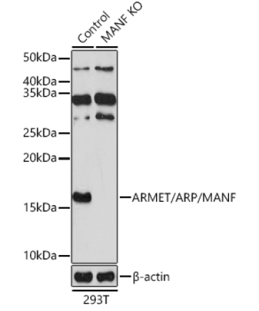 ARMET/ARP/MANF Rabbit Polyclonal Antibody [KO Validated]