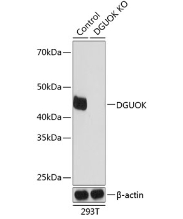 DGUOK Rabbit Polyclonal Antibody [KO Validated]