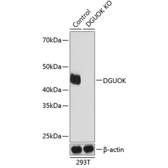 DGUOK Rabbit Polyclonal Antibody [KO Validated]
