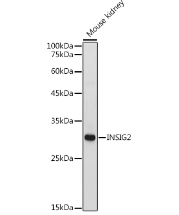INSIG2 Rabbit Polyclonal Antibody