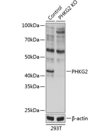 PHKG2 Rabbit Polyclonal Antibody [KO Validated]