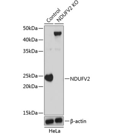 NDUFV2 Rabbit Polyclonal Antibody [KO Validated]