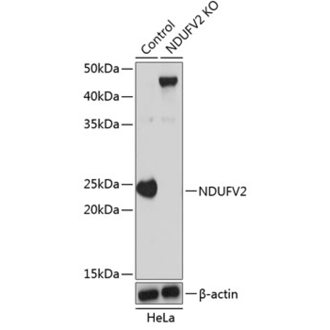 NDUFV2 Rabbit Polyclonal Antibody [KO Validated]