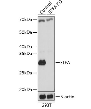 ETFA Rabbit Polyclonal Antibody [KO Validated]