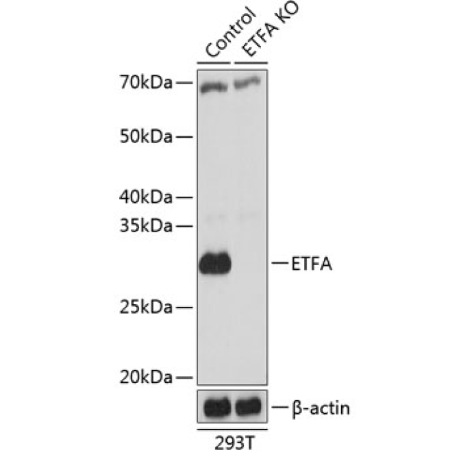 ETFA Rabbit Polyclonal Antibody [KO Validated]