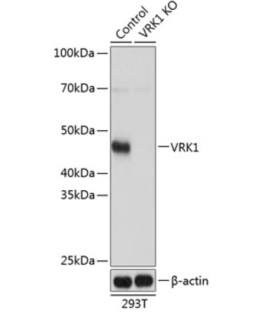 VRK1 Rabbit Polyclonal Antibody [KO Validated]
