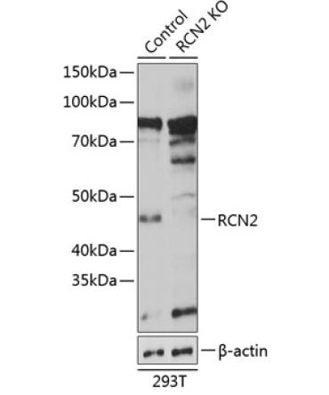 RCN2 Rabbit Polyclonal Antibody [KO Validated]