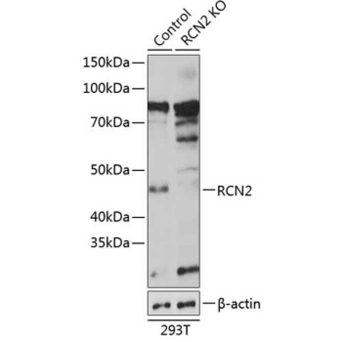 RCN2 Rabbit Polyclonal Antibody [KO Validated]