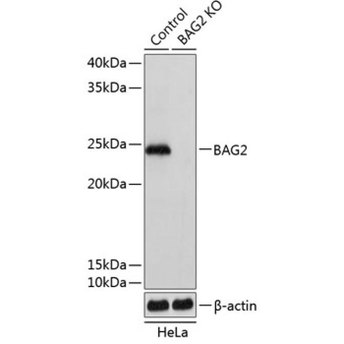 BAG2 Rabbit Polyclonal Antibody [KO Validated]