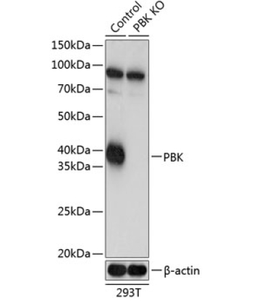 SPK Rabbit Polyclonal Antibody [KO Validated]