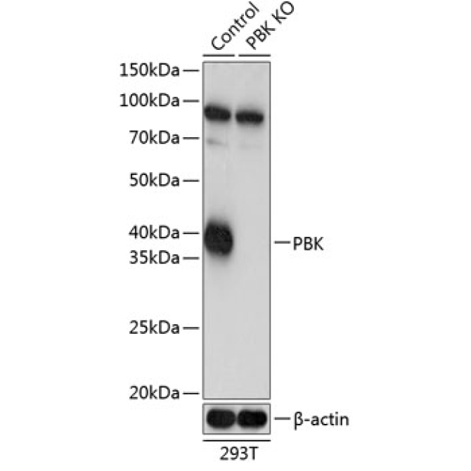 SPK Rabbit Polyclonal Antibody [KO Validated]