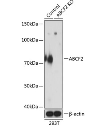 ABCF2 Rabbit Polyclonal Antibody [KO Validated]