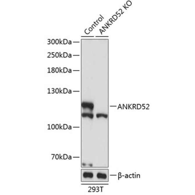 ANKRD52 Rabbit Polyclonal Antibody [KO Validated]