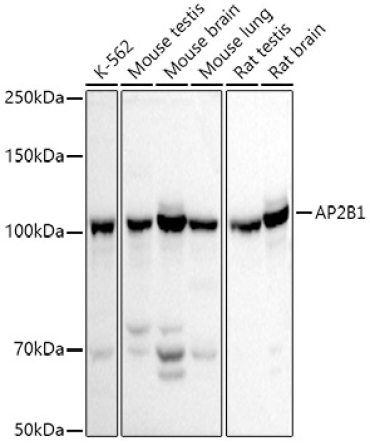 AP2B1 Rabbit Polyclonal Antibody