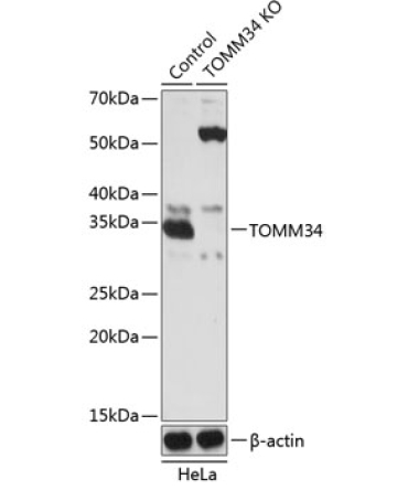 TOMM34 Rabbit Polyclonal Antibody [KO Validated]