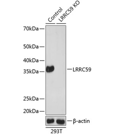 LRRC59 Rabbit Polyclonal Antibody [KO Validated]