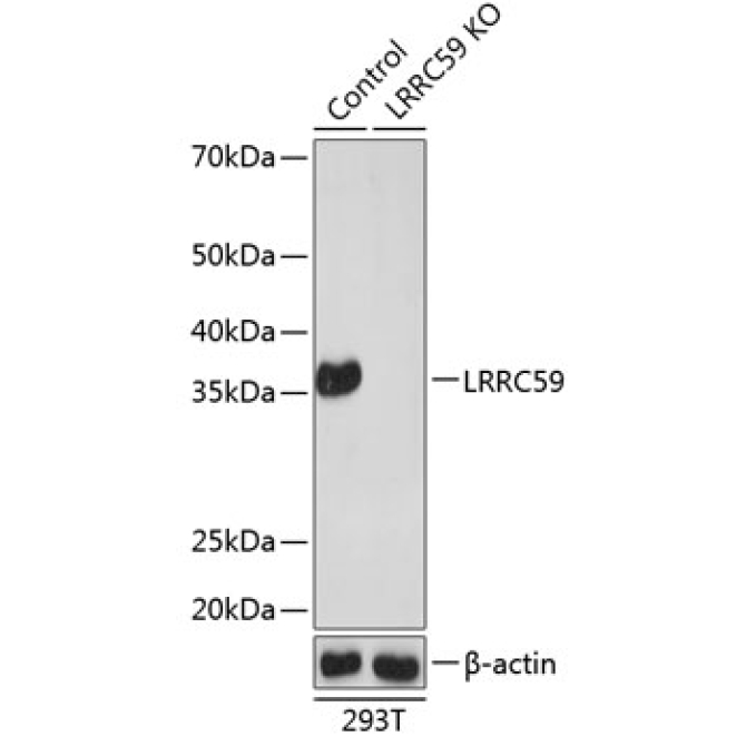 LRRC59 Rabbit Polyclonal Antibody [KO Validated]