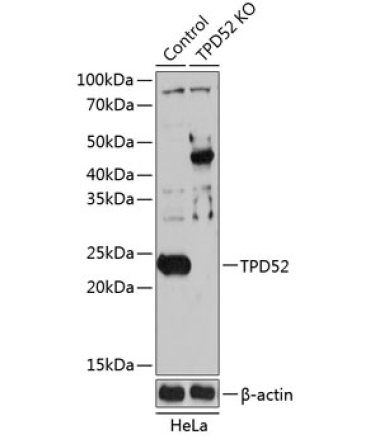 TPD52 Rabbit Polyclonal Antibody [KO Validated]