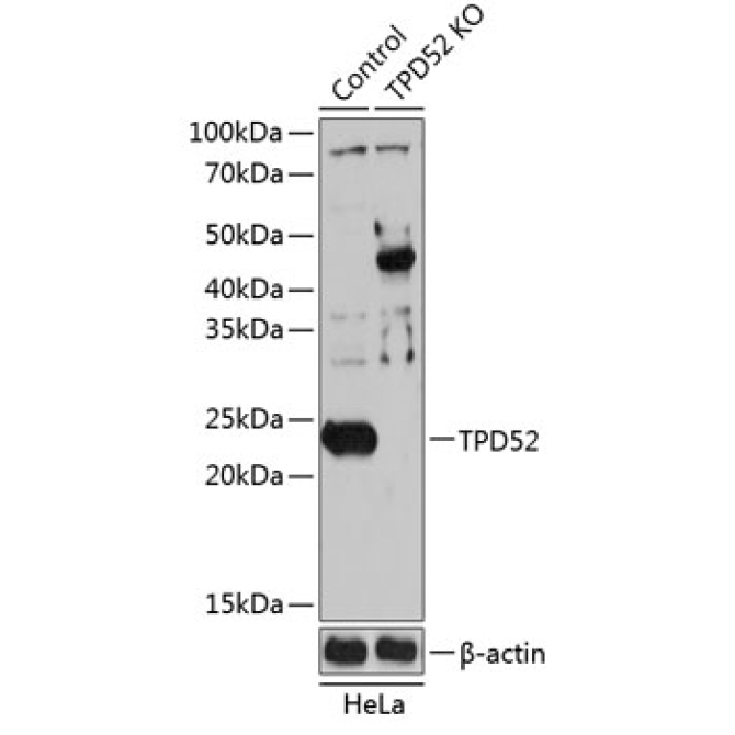 TPD52 Rabbit Polyclonal Antibody [KO Validated]