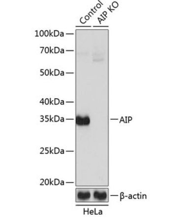 AIP Rabbit Polyclonal Antibody [KO Validated]