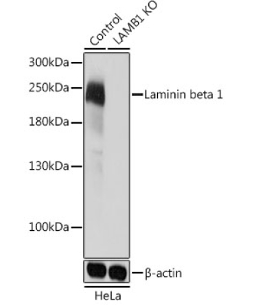 Laminin beta 1 Rabbit Polyclonal Antibody [KO Validated]