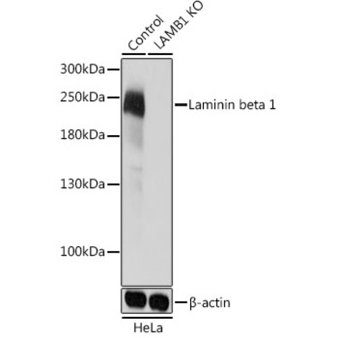 Laminin beta 1 Rabbit Polyclonal Antibody [KO Validated]