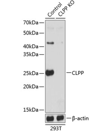 CLPP Rabbit Polyclonal Antibody [KO Validated]