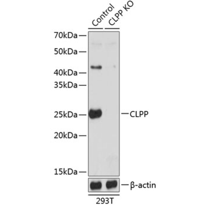 CLPP Rabbit Polyclonal Antibody [KO Validated]