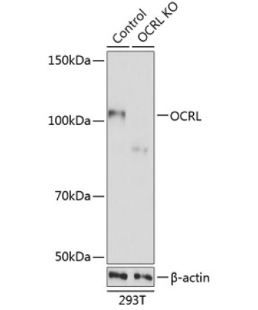 OCRL Rabbit Polyclonal Antibody [KO Validated]