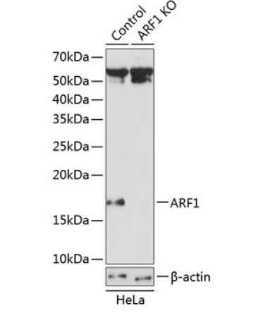 ARF1 Rabbit Polyclonal Antibody [KO Validated]