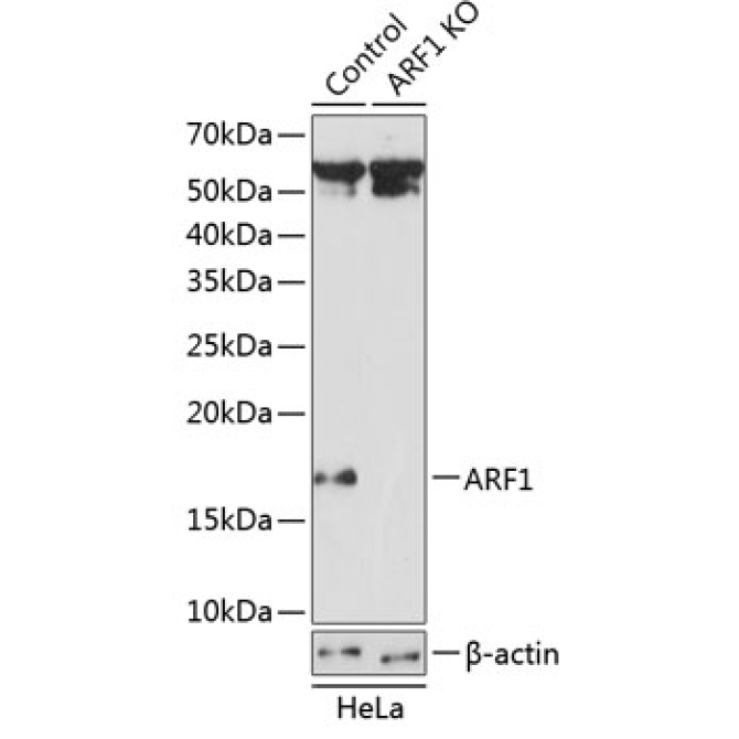 ARF1 Rabbit Polyclonal Antibody [KO Validated]