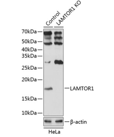LAMTOR1 Rabbit Polyclonal Antibody [KO Validated]