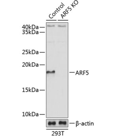 ARF5 Rabbit Polyclonal Antibody [KO Validated]