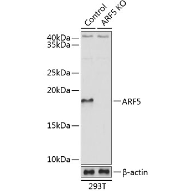 ARF5 Rabbit Polyclonal Antibody [KO Validated]