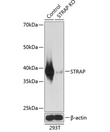 STRAP Rabbit Polyclonal Antibody [KO Validated]