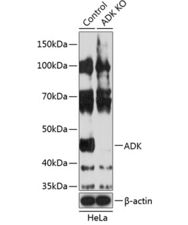 ADK Rabbit Polyclonal Antibody [KO Validated]