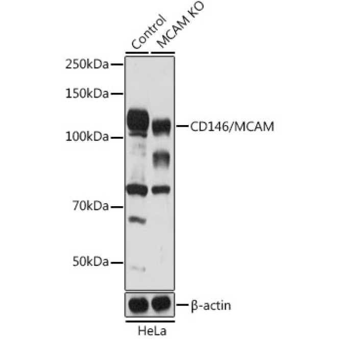CD146/MCAM Rabbit Polyclonal Antibody [KO Validated]