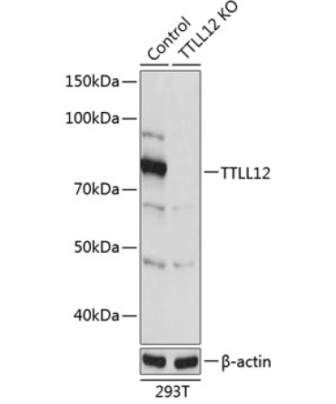 TTLL12 Rabbit Polyclonal Antibody [KO Validated]