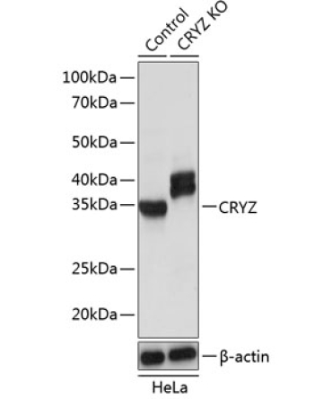 CRYZ Rabbit Polyclonal Antibody [KO Validated]