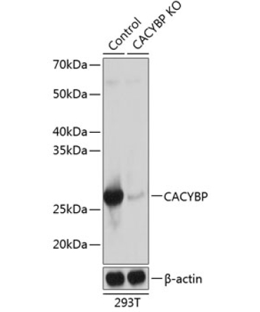 CACYBP Rabbit Polyclonal Antibody [KO Validated]