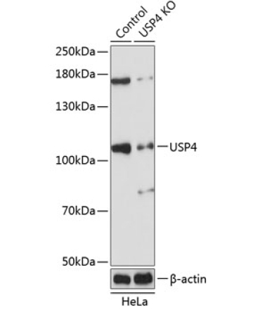 USP4 Rabbit Polyclonal Antibody [KO Validated]