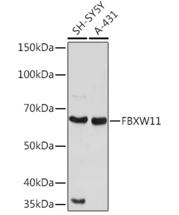 FBXW11 Rabbit Polyclonal Antibody