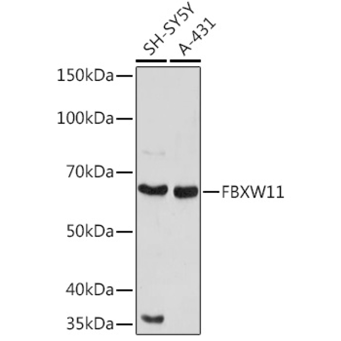 FBXW11 Rabbit Polyclonal Antibody